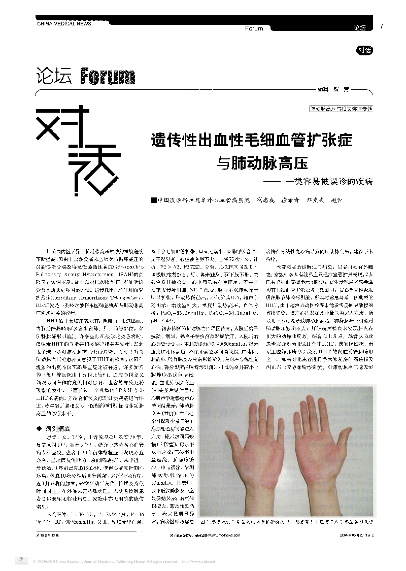 遗传的性出血性毛细血管扩张症与肺动脉高压_一类容易被误诊的疾病.