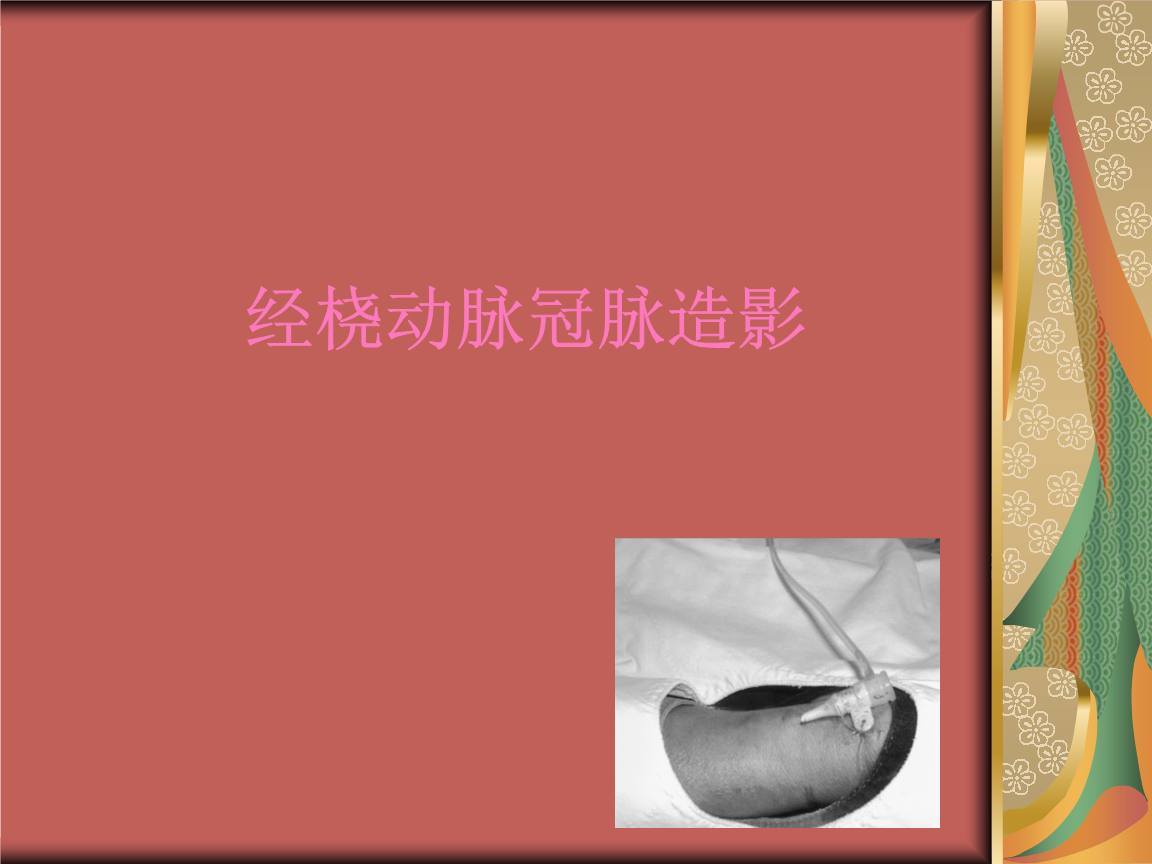 经桡动脉冠脉造影ppt.ppt