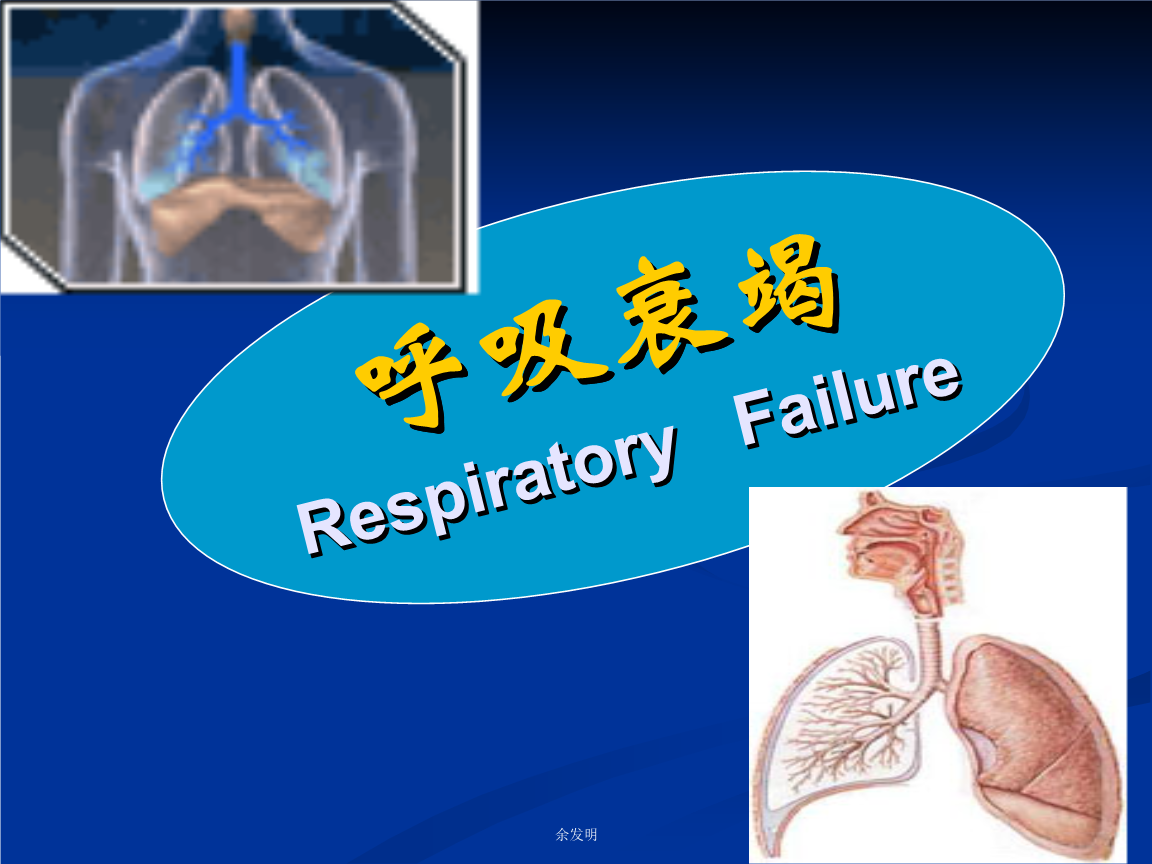 呼吸衰竭79页.ppt