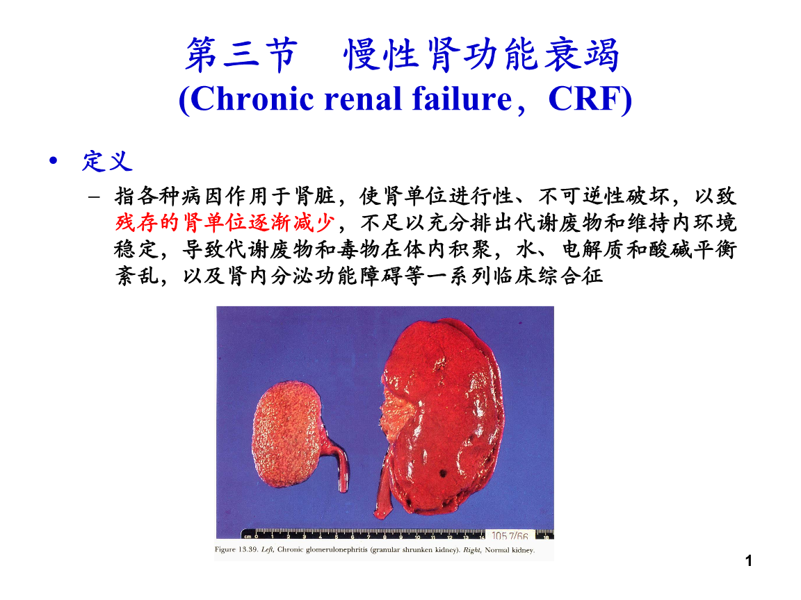 慢性肾功能衰竭的发病机制二课件.ppt
