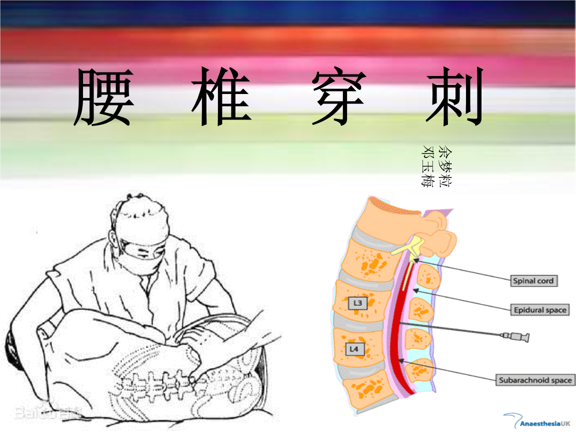 腰椎穿刺确诊流行性脑脊髓膜课件ppt10页